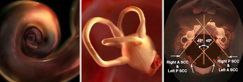HeadlinePic BPPV Series of BPPV Visualizations