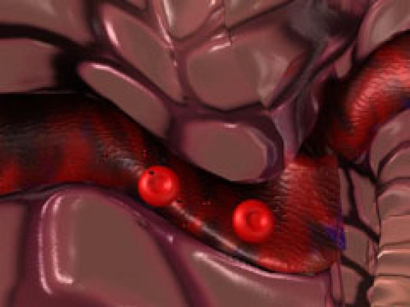 Red Cell Red Cell